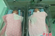 广西一对腹部连体男婴出生41天后成功分离